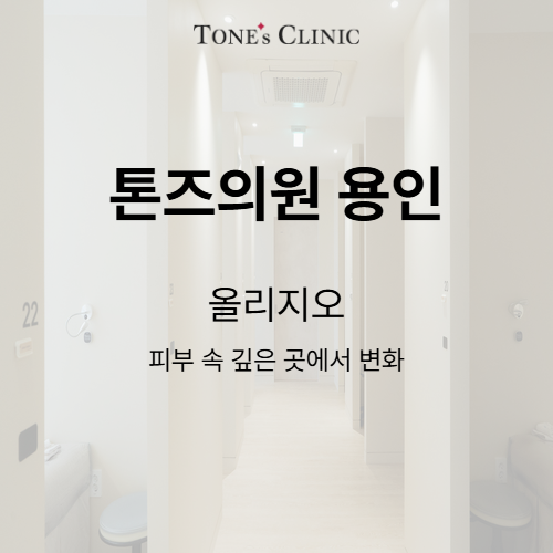 올리지오