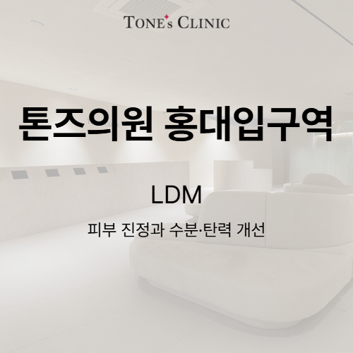 LDM