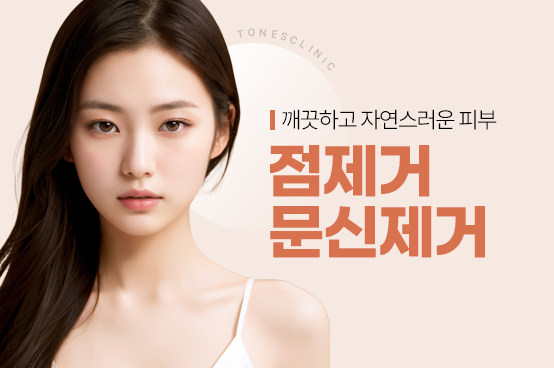 점제거/문신제거