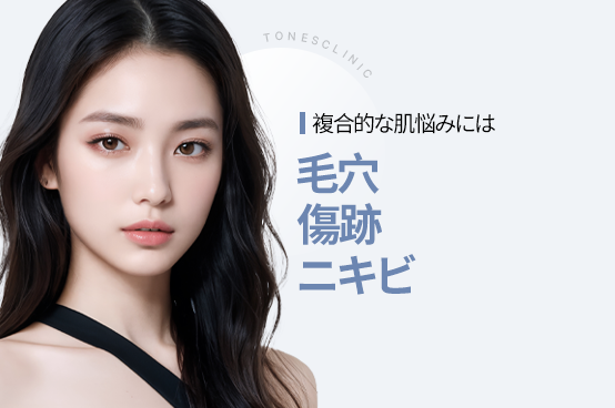 PC 이미지