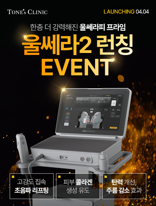 팝업