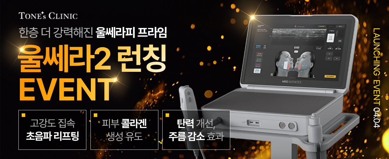 팝업