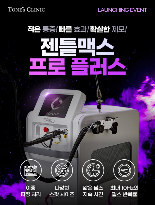팝업