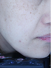 피코슈어/플러스+엑셀브이+줌패스