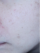 더마홍조+포텐자