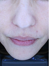 플래티넘 패키지