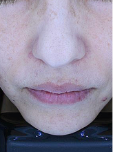 플래티넘 패키지